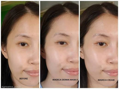 Madeca Cream